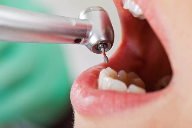Best Emergency Root Canal Treatment in Country Club Estates, GA